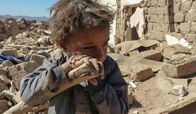 Yemen children2018.11.15